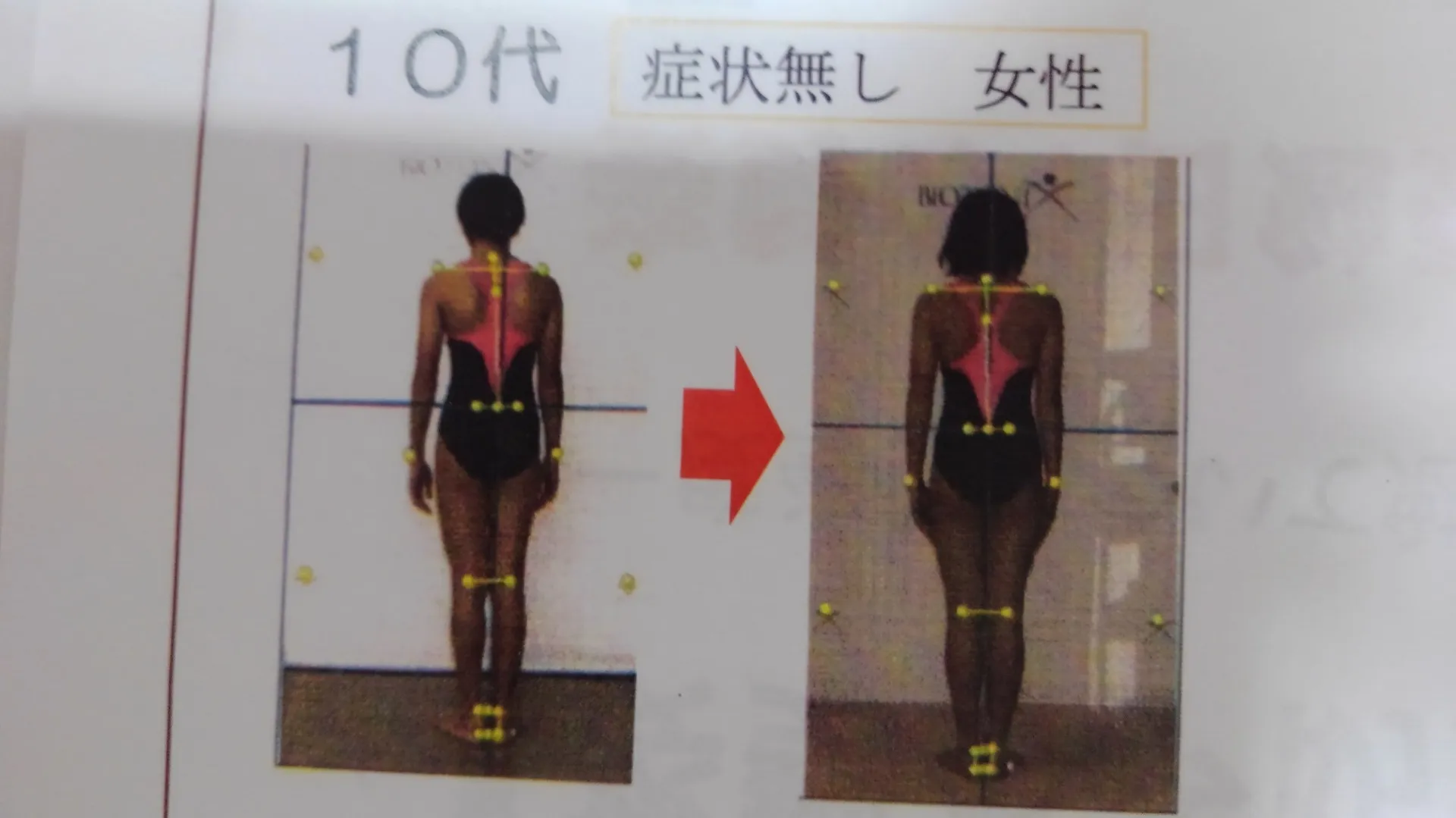 姿勢プリント変化