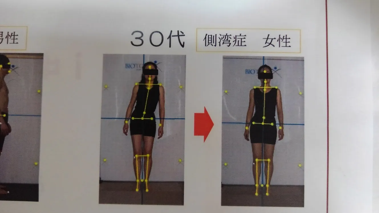 姿勢プリント変化