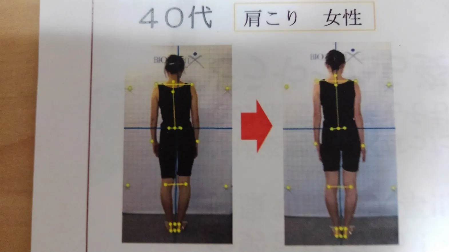 姿勢プリント変化